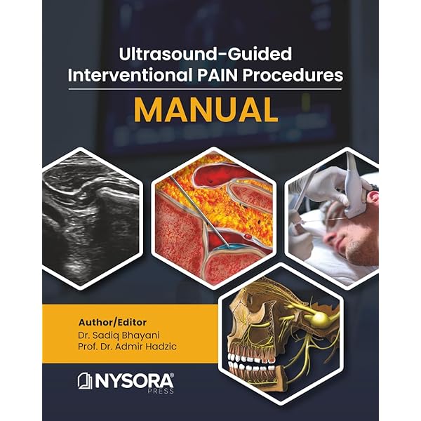 語学+参考書 Atlas of Pain Management Injection Techniques Atlas of Pain Injection Techniques: Expert Consult: Online